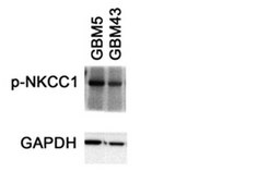 Anti-phospho-NKCC1 Antibody (Thr212/Thr217) serum, from rabbit
