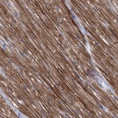 Anti-SBK2 antibody produced in rabbit Prestige Antibodies&#174; Powered by Atlas Antibodies, affinity isolated antibody, buffered aqueous glycerol solution