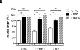 Monoclonal Anti-&#946;-Tubulin III antibody produced in mouse clone SDL.3D10, ascites fluid