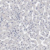 Anti-AK7 antibody produced in rabbit Prestige Antibodies&#174; Powered by Atlas Antibodies, affinity isolated antibody, buffered aqueous glycerol solution
