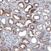 Monoclonal Anti-ABCD3 antibody produced in mouse Prestige Antibodies&#174; Powered by Atlas Antibodies, clone CL2524, purified immunoglobulin, buffered aqueous glycerol solution