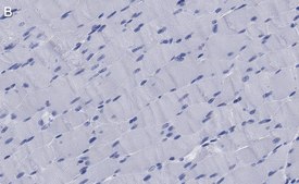 Anti-Dystrophin Antibody, clone 1G7, ZooMAb&#174; Rabbit Monoclonal recombinant, expressed in HEK 293 cells