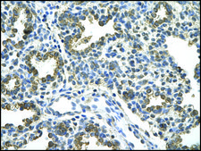 Anti-HDAC9 antibody produced in rabbit IgG fraction of antiserum