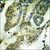 Anti-phospho-MEF2C (pSer396) antibody produced in rabbit affinity isolated antibody