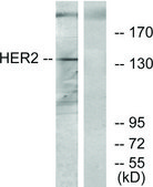 Anti-HER2 antibody produced in rabbit affinity isolated antibody