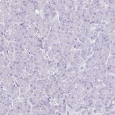 Anti-BEST1 antibody produced in rabbit Prestige Antibodies&#174; Powered by Atlas Antibodies, affinity isolated antibody