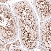 Anti-NUP54 antibody produced in rabbit Prestige Antibodies&#174; Powered by Atlas Antibodies, affinity isolated antibody, buffered aqueous glycerol solution