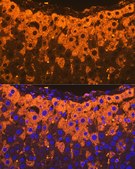 Anti-Alpha-2-Macroglobulin (A2M) Antibody, clone 7V6M10, Rabbit Monoclonal