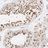 Anti-RCC1 antibody produced in rabbit Prestige Antibodies&#174; Powered by Atlas Antibodies, affinity isolated antibody, buffered aqueous glycerol solution, ab2