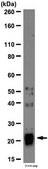 Anti-Interleukin-18 (IL-18) Antibody from rabbit, purified by affinity chromatography