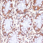 Anti-CPT1B antibody produced in rabbit