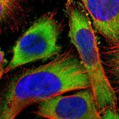 Anti-USP14 antibody produced in rabbit Prestige Antibodies&#174; Powered by Atlas Antibodies, affinity isolated antibody, buffered aqueous glycerol solution