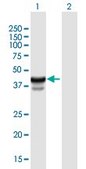 ANTI-HPR antibody produced in mouse purified immunoglobulin, buffered aqueous solution