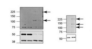 Anti-REST affinity isolated antibody
