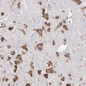 Anti-SND1 antibody produced in rabbit Prestige Antibodies&#174; Powered by Atlas Antibodies, affinity isolated antibody, buffered aqueous glycerol solution