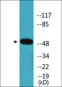 Anti-phospho-Retinoic Acid Receptor &#945; (pSer77) antibody produced in rabbit affinity isolated antibody