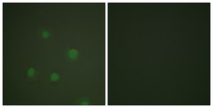 Anti-Progesterone Receptor antibody produced in rabbit affinity isolated antibody