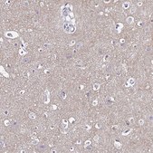 Anti-GABBR2 antibody produced in rabbit Prestige Antibodies&#174; Powered by Atlas Antibodies, affinity isolated antibody, buffered aqueous glycerol solution