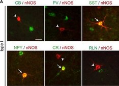 Anti-Parvalbumin Antibody ascites fluid, clone PARV-19, Chemicon&#174;