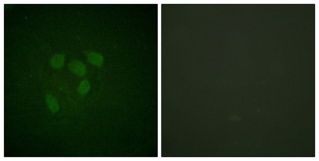 Anti-Acetyl (Lys 319) p53 Antibody, C-Terminal antibody produced in rabbit affinity isolated antibody