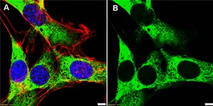 Anti-SDHD/CybS Antibody, clone 1F5-H2L2 ZooMAb&#174; Rabbit Monoclonal recombinant, expressed in HEK 293 cells