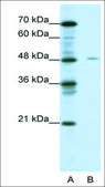 Anti-NFIX antibody produced in rabbit affinity isolated antibody
