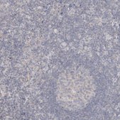 Anti-DMD antibody produced in rabbit Prestige Antibodies&#174; Powered by Atlas Antibodies, affinity isolated antibody, buffered aqueous glycerol solution