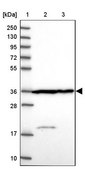 Anti-CNN2 antibody produced in rabbit Prestige Antibodies&#174; Powered by Atlas Antibodies, affinity isolated antibody, buffered aqueous glycerol solution