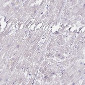 Anti-MYLK2 antibody produced in rabbit Prestige Antibodies&#174; Powered by Atlas Antibodies, affinity isolated antibody, buffered aqueous glycerol solution