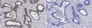 Anti-RAR-alpha Antibody, clone 3L14, ZooMAb&#174; Rabbit Monoclonal recombinant, expressed in HEK 293 cells