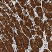 Anti-PRDX6 antibody produced in rabbit Prestige Antibodies&#174; Powered by Atlas Antibodies, affinity isolated antibody, buffered aqueous glycerol solution