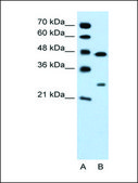 Anti-CLDN18 affinity isolated antibody