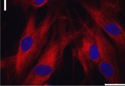 Monoclonal Anti-Actin (&#945;-Sarcomeric) antibody produced in mouse clone 5C5, ascites fluid