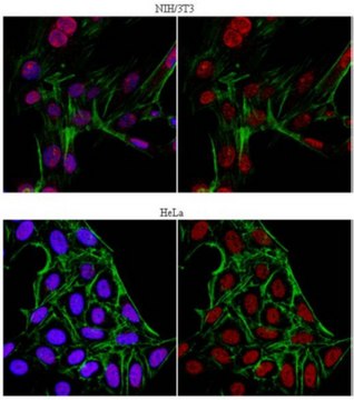 Anti-JHDM1B Antibody from rabbit, purified by affinity chromatography