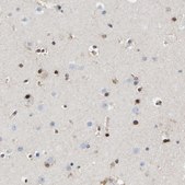 Anti-QKI antibody produced in rabbit Prestige Antibodies&#174; Powered by Atlas Antibodies, affinity isolated antibody, buffered aqueous glycerol solution