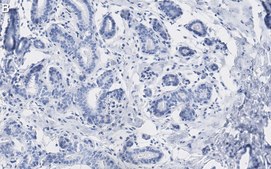 Anti-phospho-HDAC4 (S246) Antibody, clone 1I14 ZooMAb® Rabbit Monoclonal recombinant, expressed in HEK 293 cells