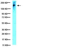 Anti-CFTR Antibody, clone MM13-4 clone MM13-4, Upstate&#174;, from mouse