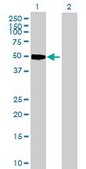 Anti-CCNE1 antibody produced in rabbit IgG fraction of antiserum, buffered aqueous solution
