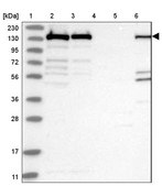 Anti-PLCG1 antibody produced in rabbit Prestige Antibodies&#174; Powered by Atlas Antibodies, affinity isolated antibody, buffered aqueous glycerol solution