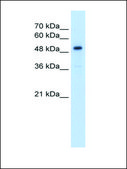 Anti-SLC1A5 IgG fraction of antiserum