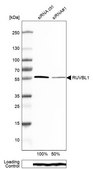 Anti-RUVBL1 antibody produced in rabbit Prestige Antibodies&#174; Powered by Atlas Antibodies, affinity isolated antibody, buffered aqueous glycerol solution