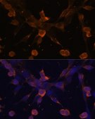 Anti-TGFBR2 antibody produced in rabbit