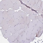 Anti-BEST1 antibody produced in rabbit Prestige Antibodies&#174; Powered by Atlas Antibodies, affinity isolated antibody