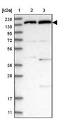 Anti-POLR2B antibody produced in rabbit Prestige Antibodies&#174; Powered by Atlas Antibodies, affinity isolated antibody, buffered aqueous glycerol solution