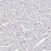Anti-PPP2R2B antibody produced in rabbit Prestige Antibodies&#174; Powered by Atlas Antibodies, affinity isolated antibody, buffered aqueous glycerol solution