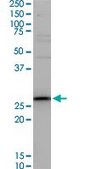 Monoclonal Anti-TNNT3, (C-terminal) antibody produced in mouse clone 1H4, ascites fluid