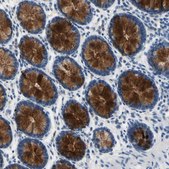 Anti-MUC5B antibody produced in rabbit Prestige Antibodies&#174; Powered by Atlas Antibodies, affinity isolated antibody, buffered aqueous glycerol solution
