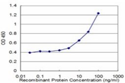 Monoclonal Anti-CYP24A1, (C-terminal) antibody produced in mouse clone 1E1, purified immunoglobulin, buffered aqueous solution