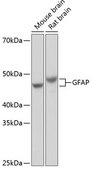 Anti-GFAP Antibody, clone 8M2F9, Rabbit Monoclonal