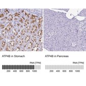 Anti-ATP4B antibody produced in rabbit Prestige Antibodies&#174; Powered by Atlas Antibodies, affinity isolated antibody, buffered aqueous glycerol solution